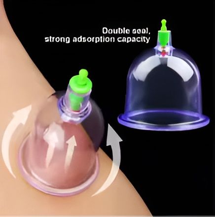 10-Piece Hijama Cupping Therapy Set | Manual Vacuum Cupping Kit