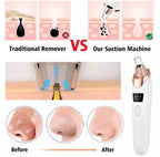 5-in-1 Rechargeable Blackhead Remover Machine | Facial Vacuum Pore Cleaner